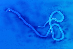 ebola-virus-edit