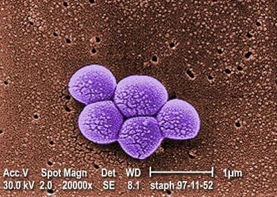 Illinois staph infection bill